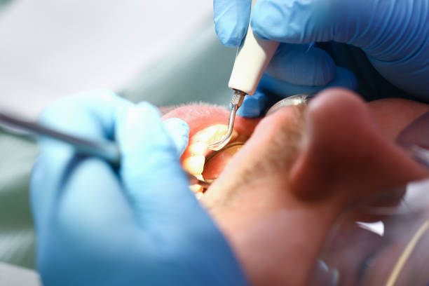 Best Knocked-Out Tooth Emergency  in West Carrollton, OH