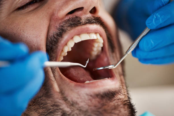 Best Urgent Tooth Repair  in West Carrollton, OH